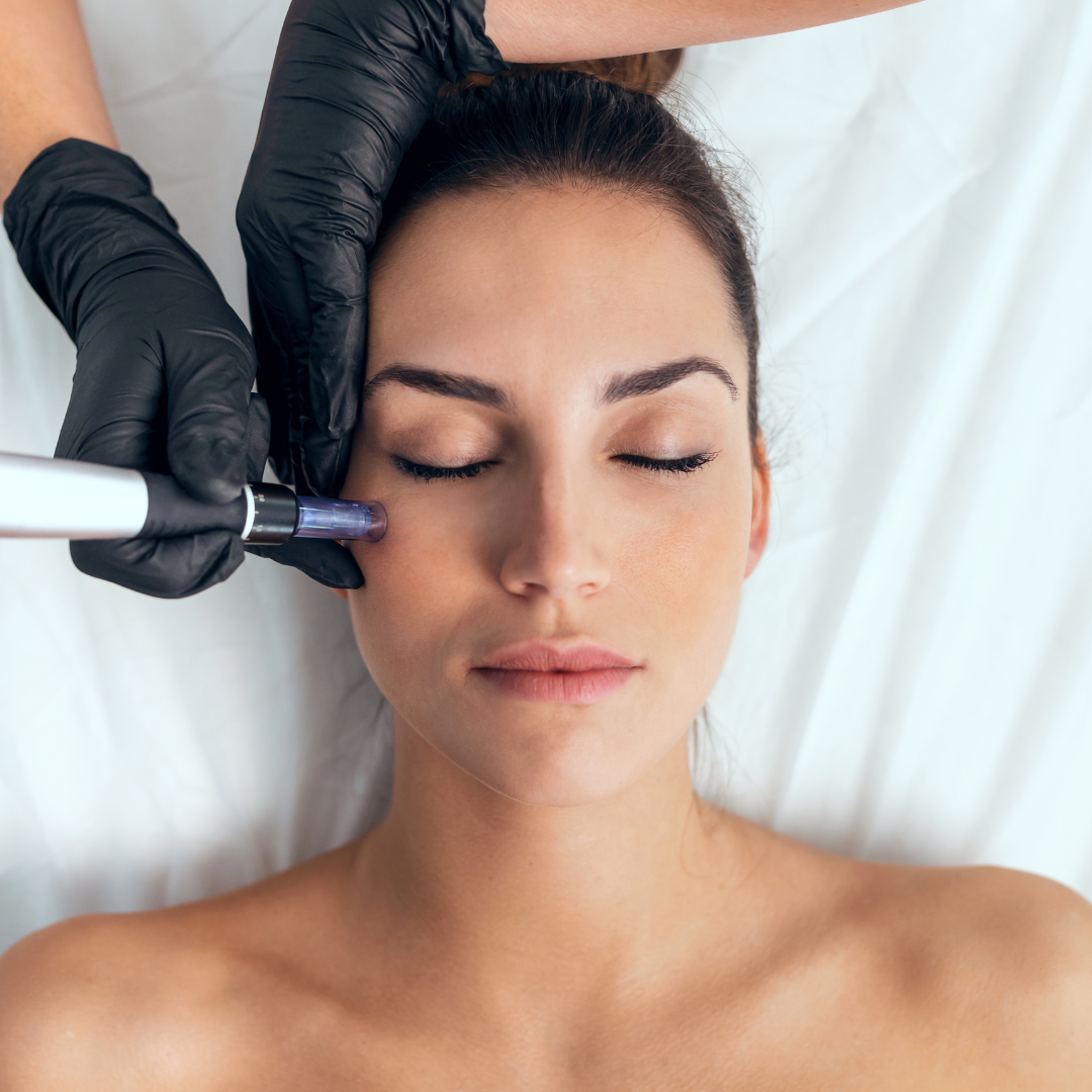 Radiofrecuencia Facial 1h