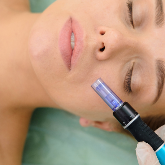 Microneedling Acné